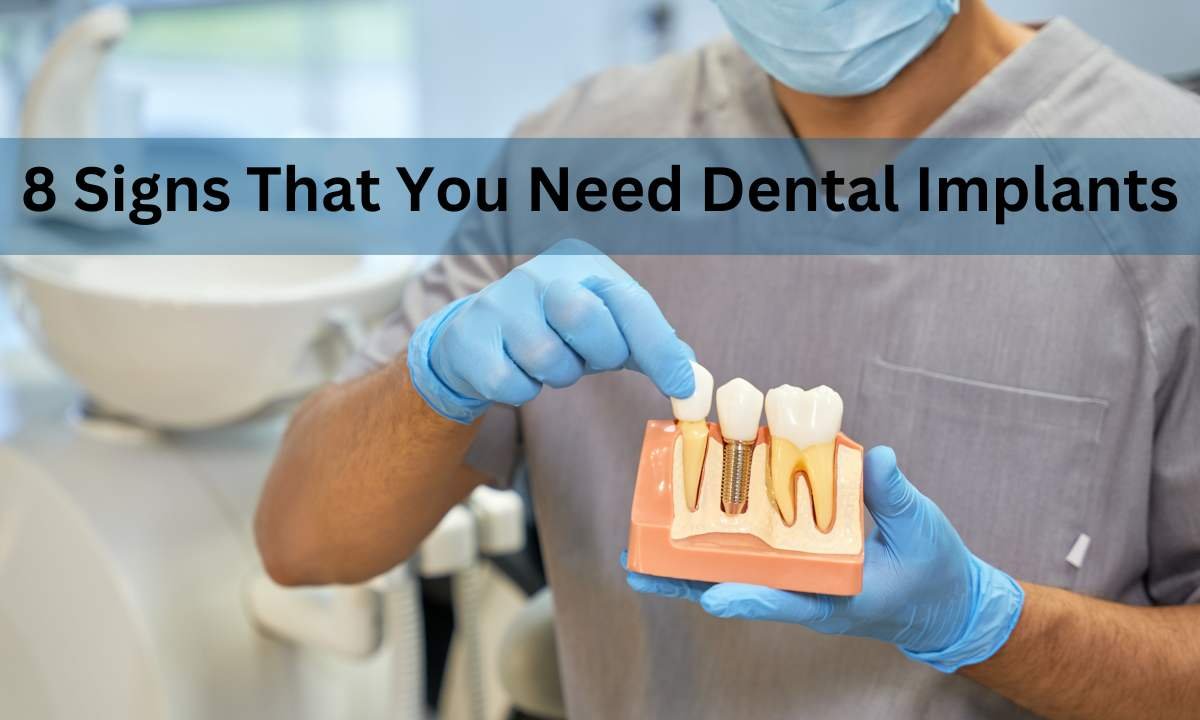 8 Signs That You Need Dental Implants